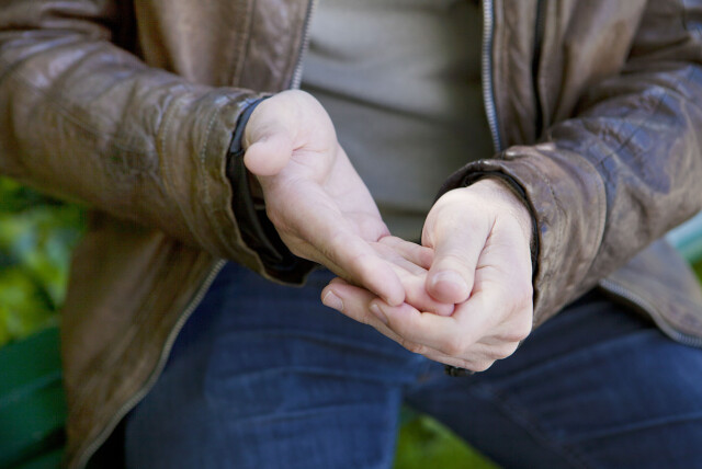 RAYNAUDS SYKDOM: Man vet ikke hvorfor noen får Raynauds sykdom. Foto: NTB Scanpix RAYNAUDS SYKDOM: Man vet ikke hvorfor noen får Raynauds sykdom. Foto: NTB Scanpix